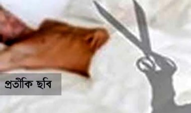 বাড়িতে ডেকে প্রেমিকের ‘বিশেষ অঙ্গ’ কাটলেন প্রেমিকা