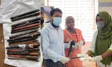 রোগীর পেট থেকে বের করা হলো ১৫ কলম!