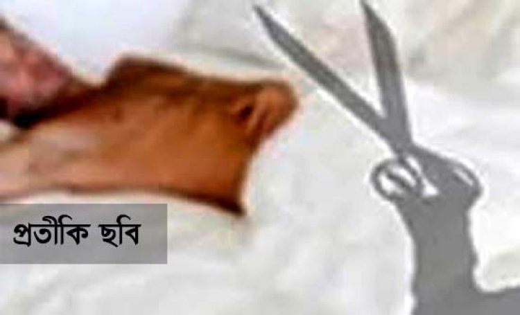 রাস্তায় ধরে ছোট বোনের স্বামীর ‘বিশেষ অঙ্গ’ কেটে দিলেন ভাইয়েরা